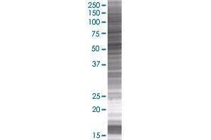 UGT3A1 transfected lysate. (UGT3A1 293T Cell Transient Overexpression Lysate(Denatured))