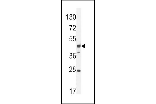 RILPL1 抗体  (C-Term)