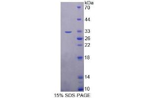 SDS-PAGE analysis of Human TOP3b Protein. (TOP3B 蛋白)