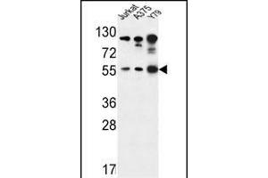 AKT1- antibody j western blot analysis in Jurkat,,Y79 cell line lysates (35 μg/lane). (AKT1 抗体  (AA 107-135))