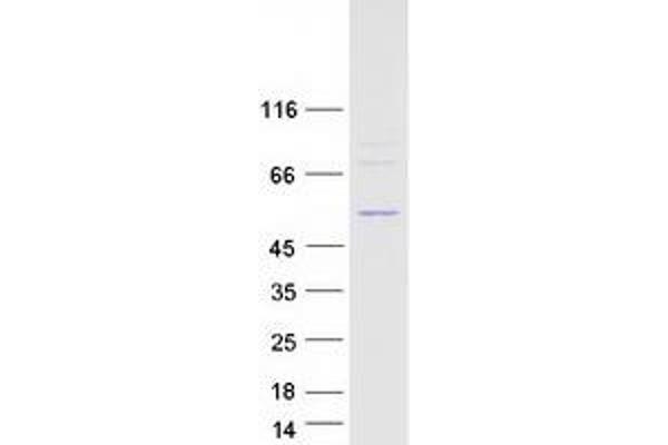 DDX47 Protein (Transcript Variant 1) (Myc-DYKDDDDK Tag)