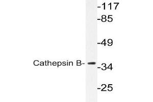 Western blot (WB) analysis of Cathepsin B Antibody in extracts from COLO cells. (Cathepsin B 抗体)