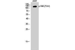 Western Blotting (WB) image for anti-PTK2 Protein tyrosine Kinase 2 (PTK2) (pTyr397) antibody (ABIN3179687) (FAK 抗体  (pTyr397))