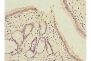 Immunohistochemistry of paraffin-embedded human pancreatic tissue using ABIN7175348 at dilution of 1:100 (VARS 抗体  (AA 1-280))