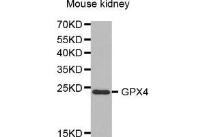 Western Blotting (WB) image for anti-Glutathione Peroxidase 4 (GPX4) (AA 30-197) antibody (ABIN6219078) (GPX4 抗体  (AA 30-197))