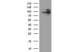 HEK293T cells were transfected with the pCMV6-ENTRY control (Left lane) or pCMV6-ENTRY FOLH1 (Right lane) cDNA for 48 hrs and lysed. (PSMA 抗体)