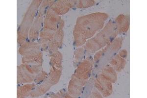 IHC-P analysis of Mouse Tissue, with DAB staining. (TNNI1 抗体  (AA 1-187))