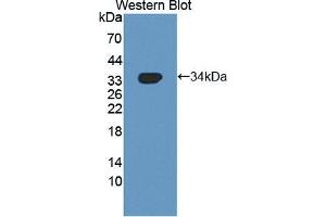 Western blot analysis of the recombinant protein. (NUAK1 抗体  (AA 421-658))