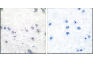 Immunohistochemistry analysis of paraffin-embedded human brain, using COT (Phospho-Thr290) Antibody. (CROT 抗体  (pThr290))