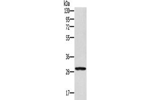 Western Blotting (WB) image for anti-Ectodysplasin A2 Receptor (EDA2R) antibody (ABIN2429982) (Ectodysplasin A2 Receptor 抗体)