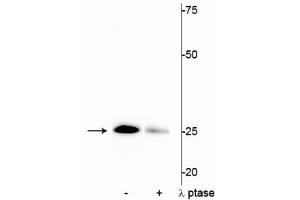 Western blot of mouse heart lysate showing specific immunolabeling of the ~25 kDa cardiac troponin I protein phosphorylated at Ser43 in the first lane (-). (TNNI3 抗体  (pSer43))