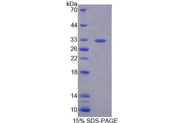 ABCB8 Protein (AA 472-735)