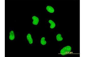 Immunofluorescence of monoclonal antibody to ZNF394 on HeLa cell. (ZNF394 抗体  (AA 1-561))