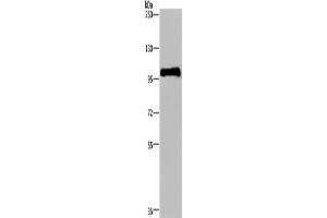 Western Blotting (WB) image for anti-Plasminogen (PLG) antibody (ABIN2435219) (PLG 抗体)