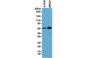 Western blot of human Jurkat and IMR32 cell lysate using recombinant SMAD4 antibody at 1:500. (Recombinant SMAD4 抗体  (C-Term))