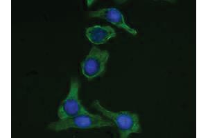 Human pancreatic carcinoma cell line MIA PaCa-2 was stained with Mouse Anti-Cytokeratin 19-FITC followed by DAPI. (Cytokeratin 19 抗体  (C-Term) (FITC))