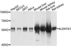 Western blot analysis of extracts of various cell lines, using ALDH7A1 antibody (ABIN5996115) at 1/1000 dilution. (ALDH7A1 抗体)