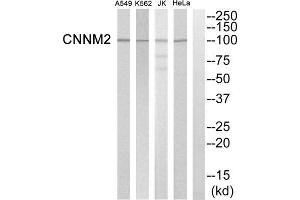 Western blot analysis of extracts from Hela cells, K562 cells, Jurkat cells and A549 cells, using CNNM2 antibody. (Cyclin M2 抗体  (Internal Region))