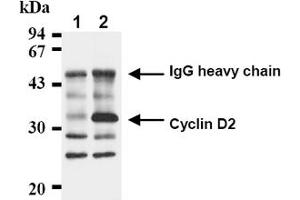 Western Blotting (WB) image for anti-Cyclin D2 (CCND2) antibody (ABIN487478) (Cyclin D2 抗体)