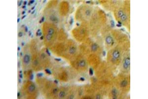 Used in DAB staining on fromalin fixed paraffin-embedded Liver tissue (GDF11 抗体  (AA 138-386))