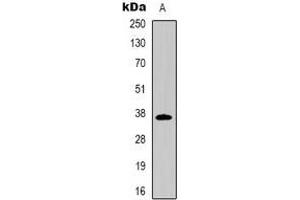 Western blot analysis of CD7 expression in Jurkat (A) whole cell lysates. (CD7 抗体)