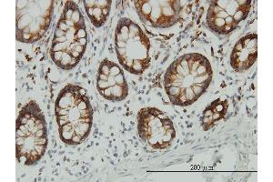 Immunostaining (ISt) image for anti-Enolase 3 (Beta, Muscle) (ENO3) (AA 228-277) antibody (ABIN560744)