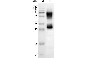 WB analysis of Human OR2B3-Nanodisc with anti-Flag monoclonal antibody at 1/5000 dilution, followed by Goat Anti-Rabbit IgG HRP at 1/5000 dilution (OR2B3 蛋白)