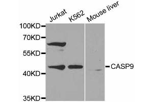 Western blot analysis of extracts of various cell lines, using CASP9 antibody (ABIN5971434) at 1:300 dilution. (Caspase 9 抗体)