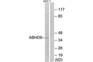Western Blotting (WB) image for anti-Epoxide Hydrolase 3 (EPHX3) (AA 101-150) antibody (ABIN2890086) (ABHD9 抗体  (AA 101-150))