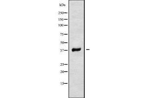 Western blot analysis of RNF167 using MCF7 whole cell lysates (RNF167 抗体  (Internal Region))