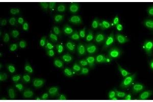 Immunofluorescence analysis of U2OS cells using EWSR1 Polyclonal Antibody (EWSR1 抗体)