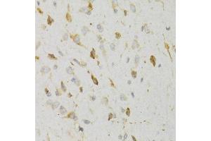 Immunohistochemistry of paraffin-embedded rat brain using KISS1R Antibody (ABIN5971525) at dilution of 1/100 (40x lens). (KISS1R 抗体)