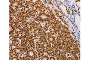 Immunohistochemistry (IHC) image for anti-Proteasome (Prosome, Macropain) 26S Subunit, Non-ATPase, 3 (PSMD3) antibody (ABIN3023700) (PSMD3 抗体)