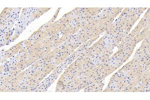 Detection of TGFb1 in Human Cardiac Muscle Tissue using Polyclonal Antibody to Transforming Growth Factor Beta 1 (TGFb1) (TGFB1 抗体  (AA 279-390))