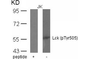 Image no. 1 for anti-Lymphocyte-Specific Protein tyrosine Kinase (LCK) (pTyr505) antibody (ABIN401553) (LCK 抗体  (pTyr505))