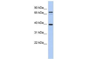 NYD-SP21 antibody used at 1 ug/ml to detect target protein. (MS4A14 抗体  (Middle Region))