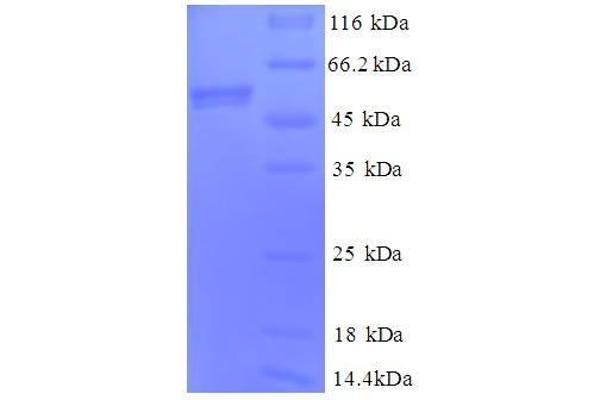 Cytochrome C1 Protein (CYC1) (AA 85-325, full length) (GST tag)