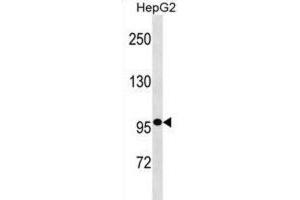 Western Blotting (WB) image for anti-Glucosidase, Alpha, Neutral C (GANC) antibody (ABIN3000510) (GANC 抗体)