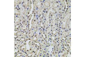 Immunohistochemistry of paraffin-embedded rat kidney using SMARCC2 antibody (ABIN1874865) at dilution of 1:100 (40x lens). (SMARCC2 抗体)