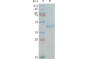 Human (567-667) Protein, hFc Tag on SDS-PAGE under reducing condition. (LI Cadherin Protein (AA 567-667) (Fc Tag))