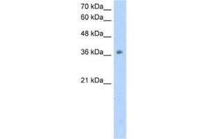 Western Blotting (WB) image for anti-Ornithine Carbamoyltransferase (OTC) antibody (ABIN2462472) (OTC 抗体)