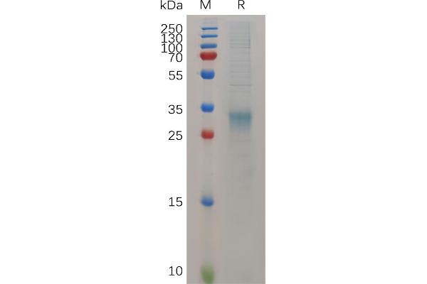 IFNB1 Protein (AA 22-182) (His tag)