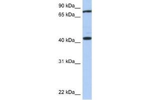 TEX9 antibody used at 1 ug/ml to detect target protein. (TEX9 抗体  (Middle Region))