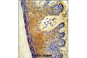 Formalin-fixed and paraffin-embedded human skin tissue reacted with ALOX15B Antibody ,which was peroxidase-conjugated to the secondary antibody, followed by DAB staining. (ALOX15B 抗体  (C-Term))