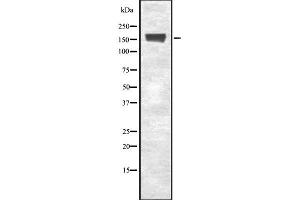 Western blot analysis of EEA1 using Jurkat whole cell lysates (EEA1 抗体  (Internal Region))