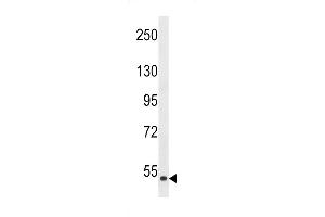 Western blot analysis in HepG2 cell line lysate (35ug/lane). (ZAK 抗体  (AA 271-300))