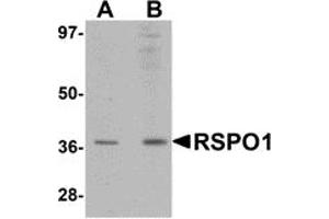 Western Blotting (WB) image for anti-R-Spondin 1 (RSPO1) (N-Term) antibody (ABIN1031546) (RSPO1 抗体  (N-Term))