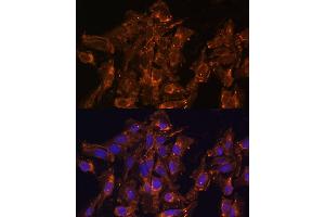 Immunofluorescence analysis of U-2 OS cells using HSD17B8 Polyclonal Antibody  at dilution of 1:100 (40x lens). (HSD17B8 抗体  (AA 1-261))