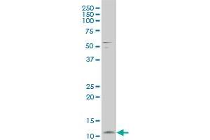 FXYD3 polyclonal antibody (A01), Lot # ISI4060209QCS1 Western Blot analysis of FXYD3 expression in A-431 (FXYD3 抗体  (AA 21-87))