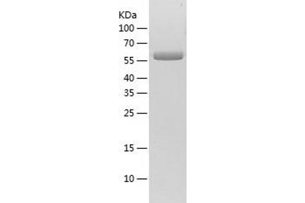 GGT1 Protein (AA 28-569) (His tag)